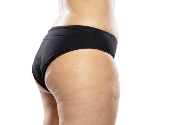 Top 5 des recettes végétariennes anti-cellulite pour un corps de rêve !